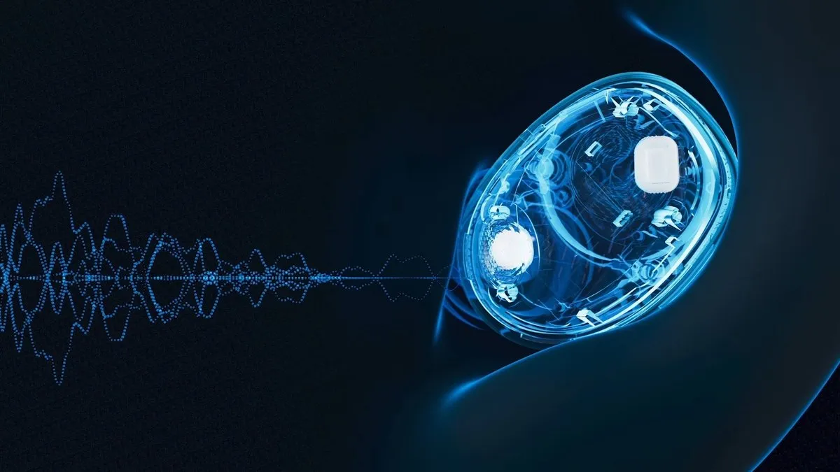 Нові Sennheiser MOMENTUM True Wireless 5 (2026) — Бездротові Навушники зі Знімними Батареями 6 MOMENTUM True Wireless 5 мікрофон